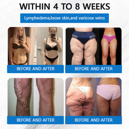 Best Seller-LBMLBM® SMGT-GLP-1 𝐓𝐢𝐫𝐳𝐞𝐩𝐚𝐭𝐢𝐝𝐞 & 𝐂𝐨𝐥𝐥𝐚𝐠𝐞𝐧 𝐍𝐚𝐧𝐨 𝐌𝐢𝐜𝐫𝐨𝐧𝐞𝐞𝐝𝐥𝐞 𝐖𝐞𝐢𝐠𝐡𝐭 𝐋𝐨𝐬𝐬 𝐏𝐚𝐭𝐜𝐡丨Targets Obesity, Loose Skin, High Blood Pressure, Diabetes, Fatty Liver, Joint Pain, Brain Fog, Low Energy, Body Aches, and More
